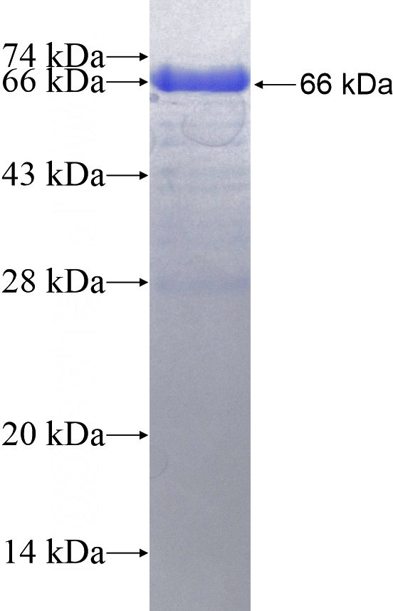 Recombinant Human KATNB1 SDS-PAGE