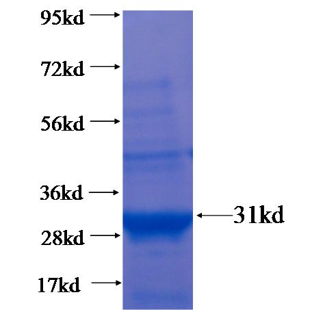 Recombinant human CNPY1 SDS-PAGE
