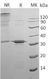 Human ATG5/APG5L/ASP recombinant protein
