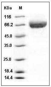 Human ALCAM / CD166 Protein (His Tag) SDS-PAGE