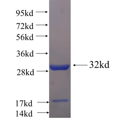 Recombinant human C1orf163 SDS-PAGE