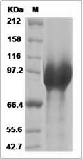 Cynomolgus Autotaxin / ENPP2 Protein (His Tag) SDS-PAGE