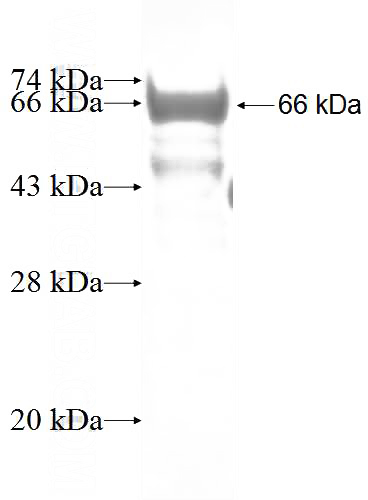 Recombinant Human FOXN2 SDS-PAGE