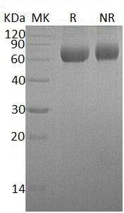 Human TMPRSS11B/HATL5 (His tag) recombinant protein