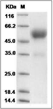 Mouse Frizzled-5 / FZD5 Protein (Fc Tag) SDS-PAGE