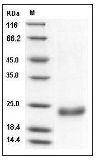 Human IFNL3 / IL28B / Interleukin-28B Protein (His Tag) SDS-PAGE
