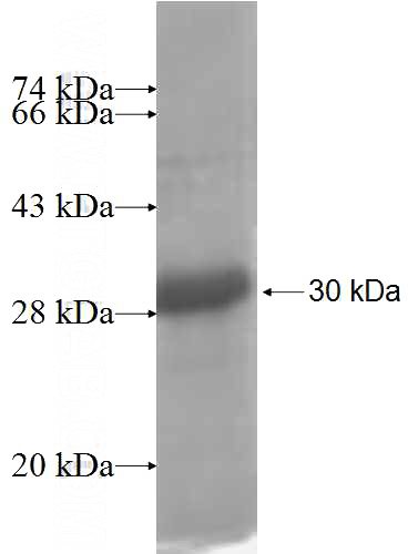 Recombinant Human OVCA2 SDS-PAGE