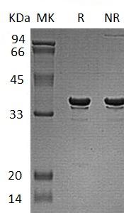 Human MORF4L2/KIAA0026/MRGX (His tag) recombinant protein