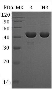 Human PGK1/PGKA/MIG10/OK/SW-cl.110 (His tag) recombinant protein
