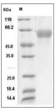Influenza A H5N1 (A/Cambodia/S1211394/2008) Hemagglutinin Protein (HA1 Subunit) (His Tag) SDS-PAGE
