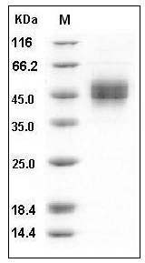 Human MICB Protein (His Tag) SDS-PAGE