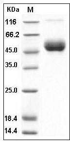 Human IL-1R8 / IL1RAPL1 Protein (His Tag) SDS-PAGE
