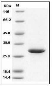 Human 14-3-3 sigma / Stratifin / YWHAS Protein SDS-PAGE