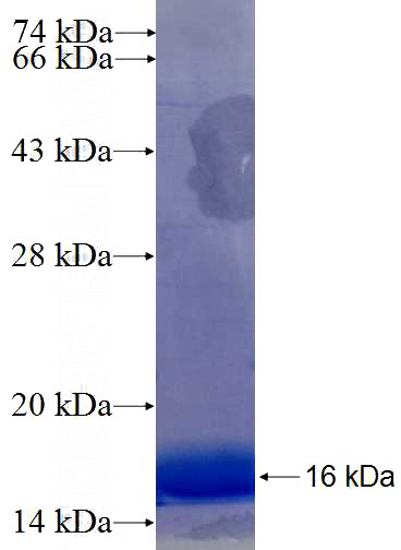 Recombinant Human WFS1 SDS-PAGE