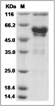Cynomolgus XEDAR / EDA2R Protein (Fc Tag) SDS-PAGE