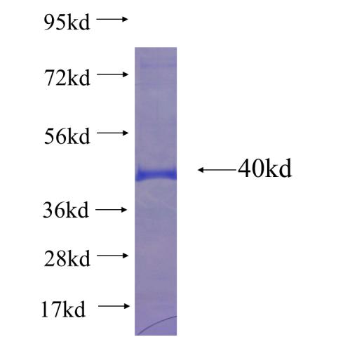 Recombinant human FADS3 SDS-PAGE