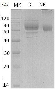 Human LILRA3/ILT6/LIR4 (His tag) recombinant protein