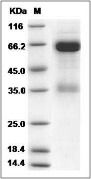 Rat NCR1 / NK-p46 Protein (Fc Tag) SDS-PAGE