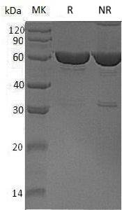 Human CES1/CES2/SES1 (His tag) recombinant protein