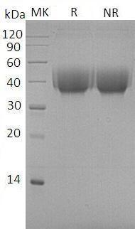 Cynomolgus CD80/EGK_11324 (His tag) recombinant protein