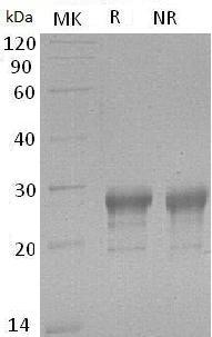 Human PTGDS/PDS (His tag) recombinant protein