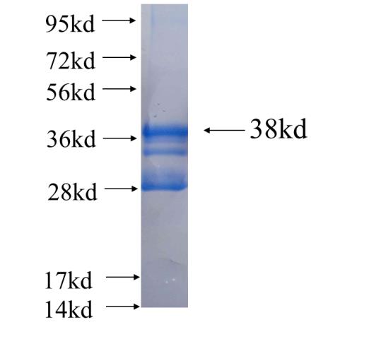 Recombinant human C20orf149 SDS-PAGE