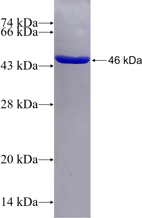 Recombinant Human LEF1 SDS-PAGE