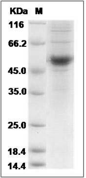 Rat CD40L / CD154 / TNFSF5 Protein (Fc Tag) SDS-PAGE