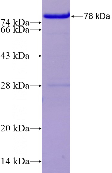 Recombinant Human SPARCL1 SDS-PAGE