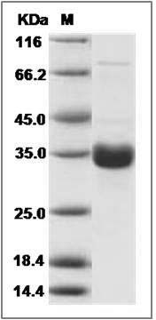 Mouse CL-K1 / COLEC11 Protein (His Tag) SDS-PAGE