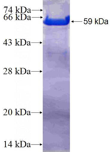 Recombinant Human TPX2 SDS-PAGE