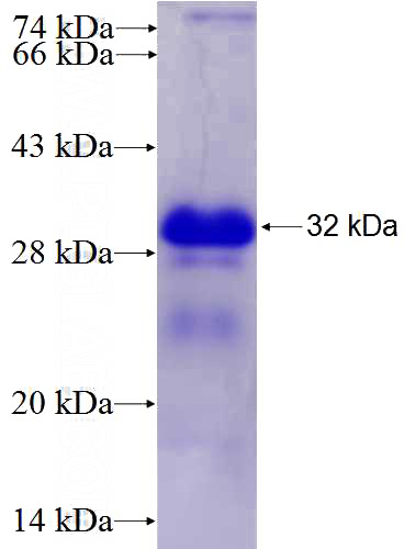 Recombinant Human FOS SDS-PAGE