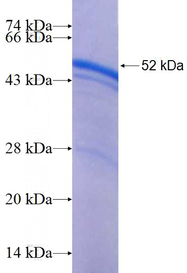 Recombinant Human STAT5A SDS-PAGE