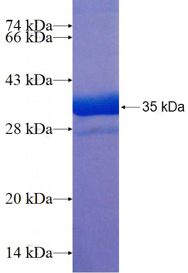 Recombinant Human UFM1 SDS-PAGE