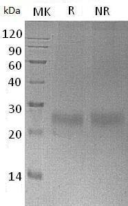 Mouse Csf3/Csfg (His tag) recombinant protein
