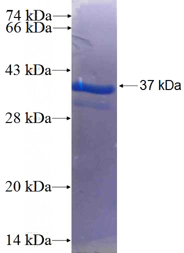 Recombinant Human CMTM4 SDS-PAGE