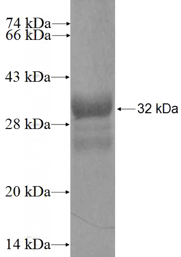Recombinant Human COL4A6 SDS-PAGE