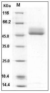 Human B4GALT1 / GGTB2 Protein (His Tag) SDS-PAGE