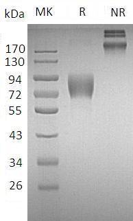 Human CD226/DNAM1 (Fc tag) recombinant protein