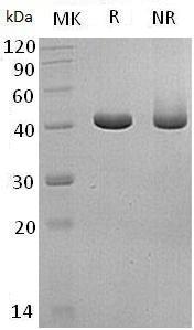 Human GCDH (His tag) recombinant protein
