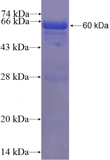 Recombinant Human CLTC SDS-PAGE