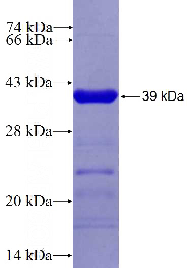 Recombinant Human OGFR SDS-PAGE