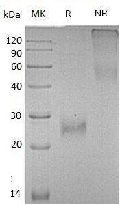 Human CLEC4E/CLECSF9/MINCLE/UNQ218 (His tag) recombinant protein