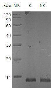 Mouse S100a15a/S100a15/S100a7/S100a7a recombinant protein