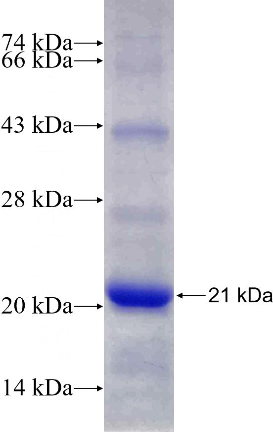 Recombinant Human TCEB2 SDS-PAGE