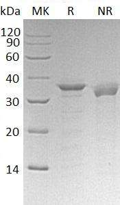 Human ETS1/EWSR2 (His tag) recombinant protein