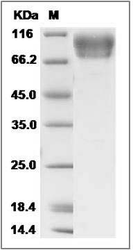 Cynomolgus E-Selectin / CD62e / SELE Protein (His Tag) SDS-PAGE