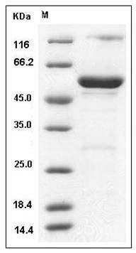 Human HNMT / Histamine N-methyltransferase Protein (GST Tag) SDS-PAGE