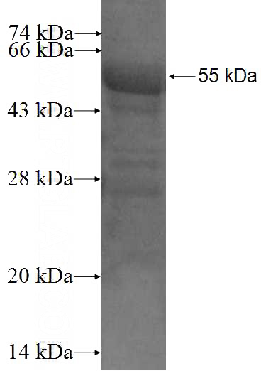 Recombinant Human NECAB2 SDS-PAGE