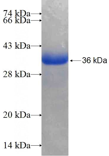 Recombinant Human AKR7A2 SDS-PAGE
